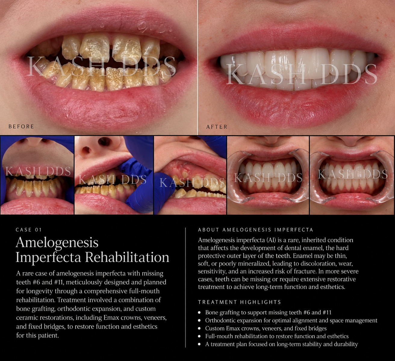 KASH DDS watermarked clinical case photographs documenting rehabilitation